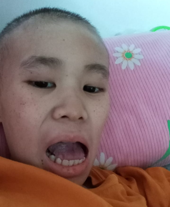 Mengidap Tumor Ginjal Stadium Empat, Adrian Butuh Uluran Tangan.