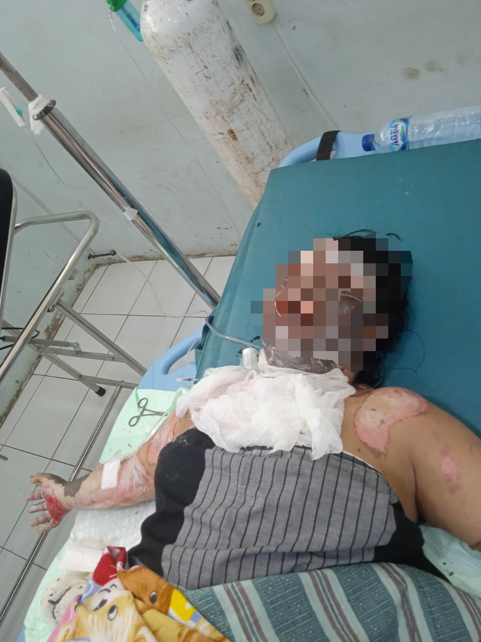 Sempat Cekcok Mulut, Suami Tega Bakar Istri