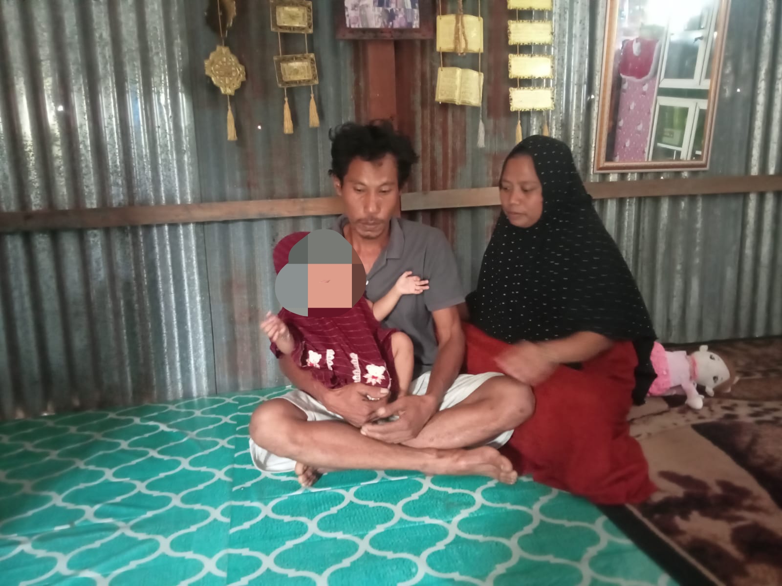 Lahir Tanpa Anus, Siti BAB Lewat Kemaluan