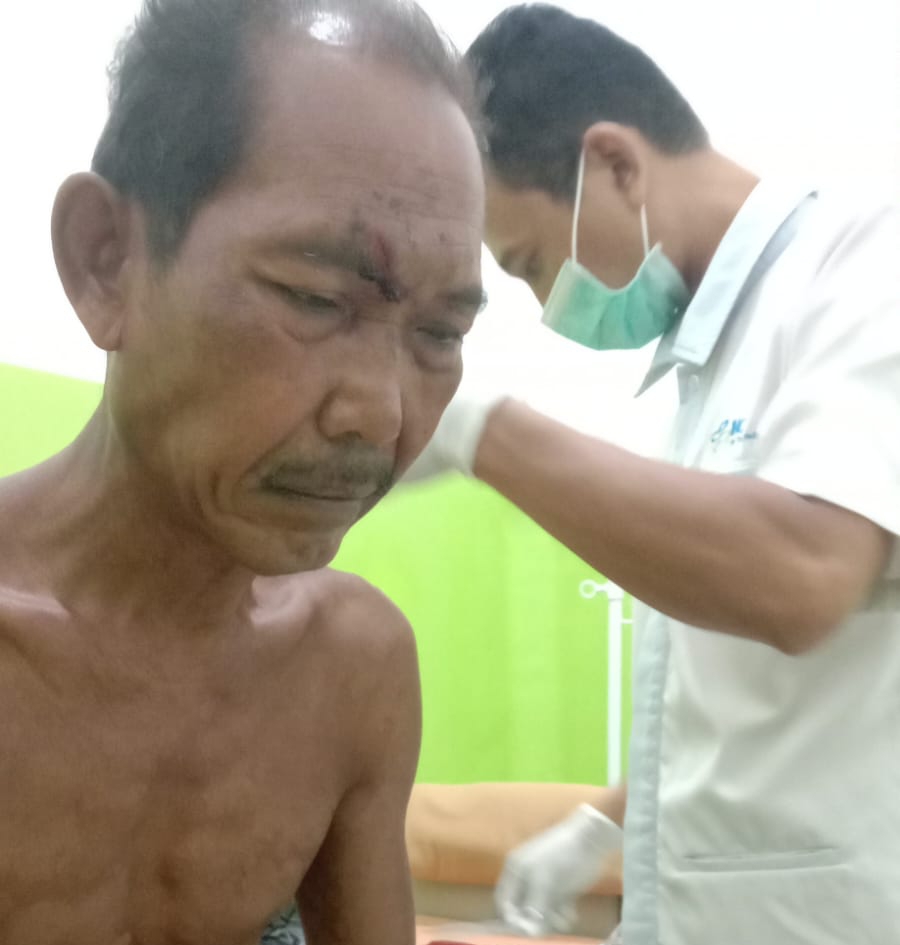 Kakak Bacok Tangan dan Punggung Adiknya Sendiri