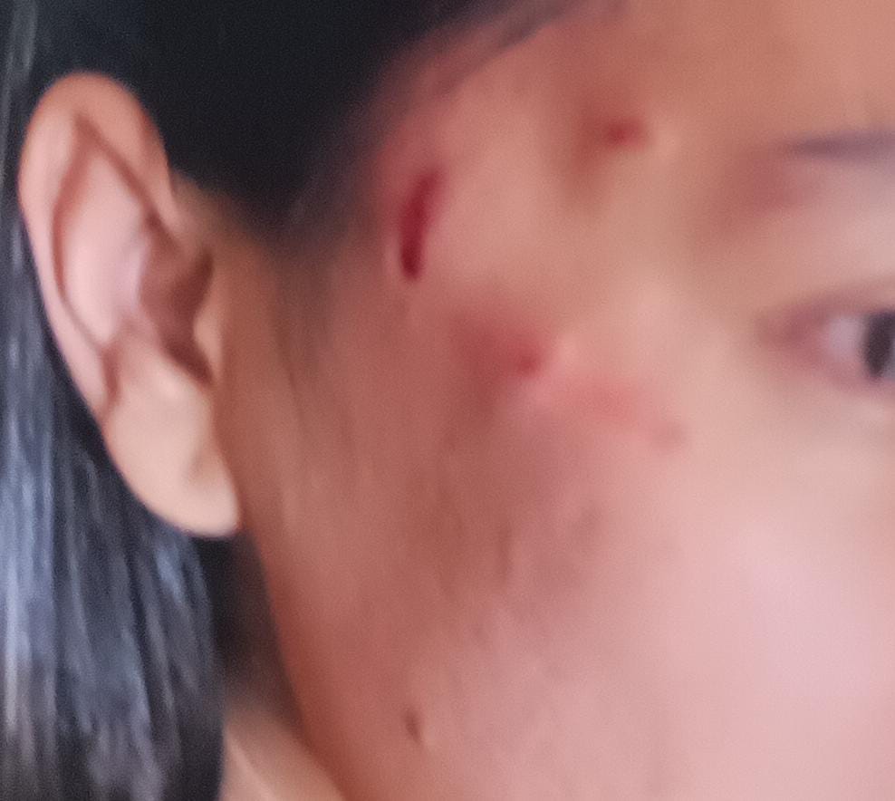 Ternyata V Sudah Empat Kali Lapor ke Polisi