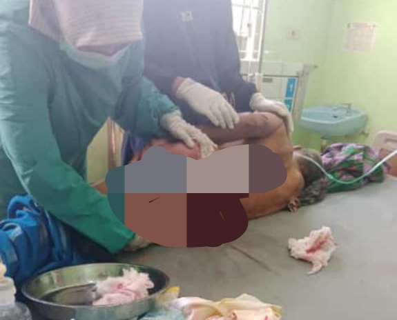 Sedang Cari Udang, Pria 75 Tahun Diterkam Buaya Sepanjang Empat Meter